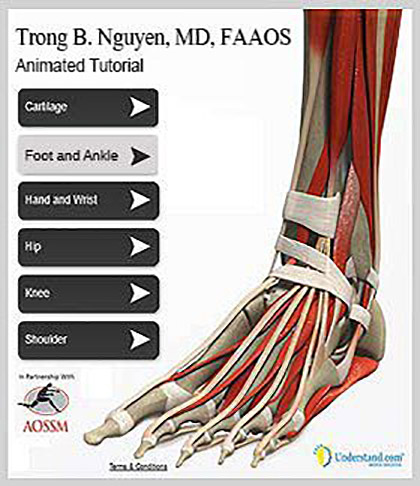 skeletal image of foot, ankle and heel surgery